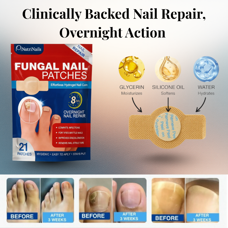 NutriPatch™ - Fungal Nail Renewal Patches