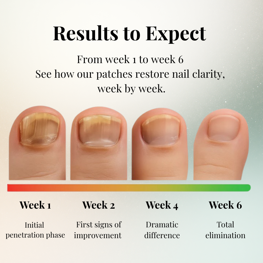 NutriPatch™ - Fungal Nail Renewal Patches