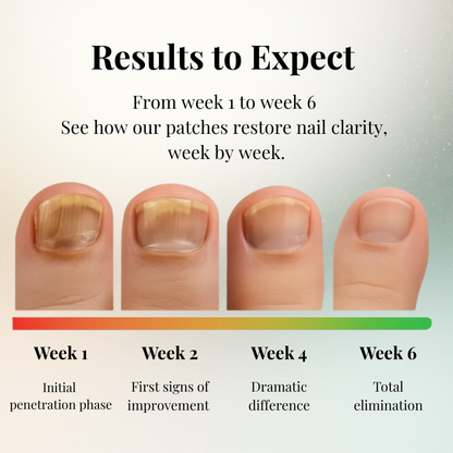 NutriPatch™ - Fungal Nail Renewal Patches