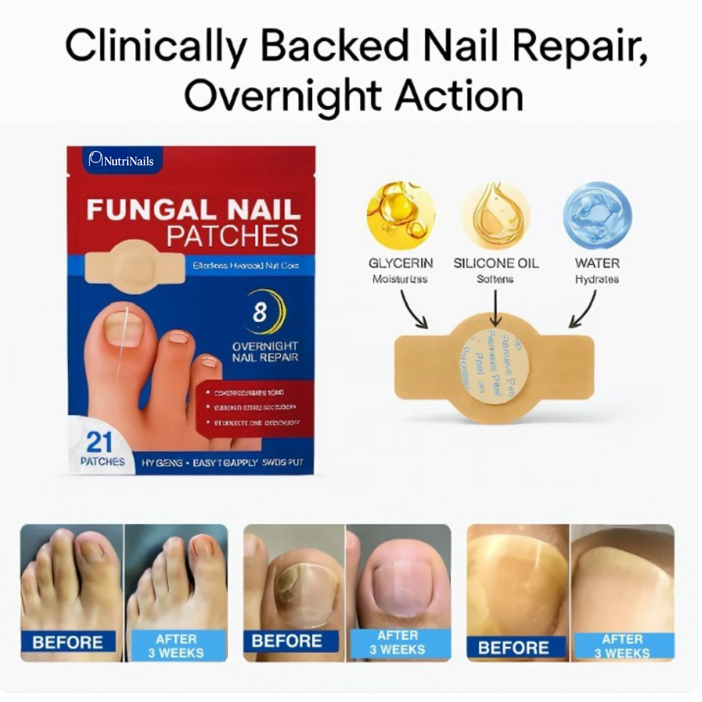 NutriPatch™ - Fungal Nail Renewal Patches